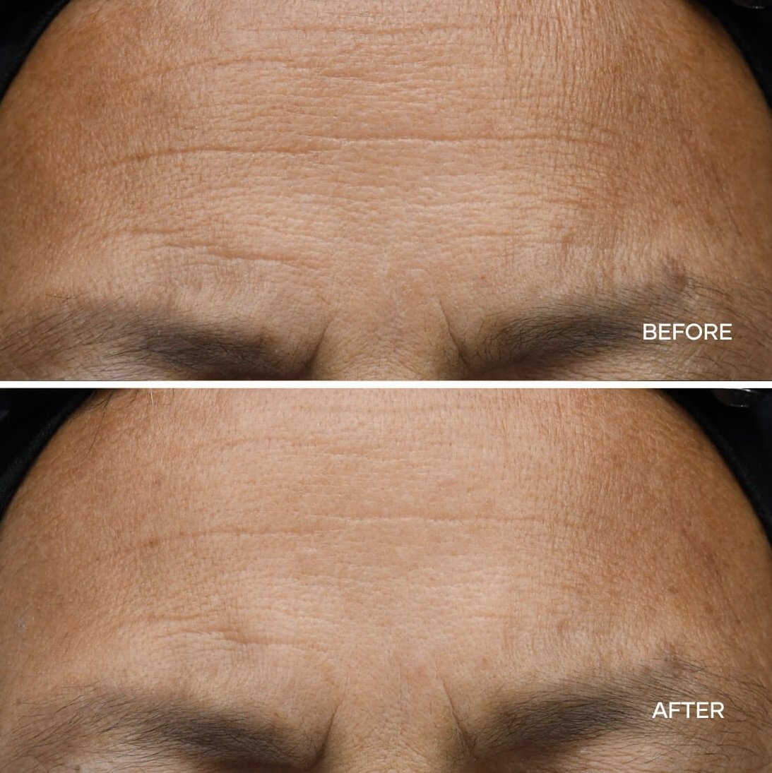 shaklee face wand peptides wrinkle treatment for men - Skin Care for Men shaklee face wand peptides wrinkle treatment for men